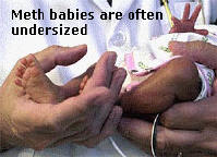 Undersized Baby Exposed to Meth Before Birth